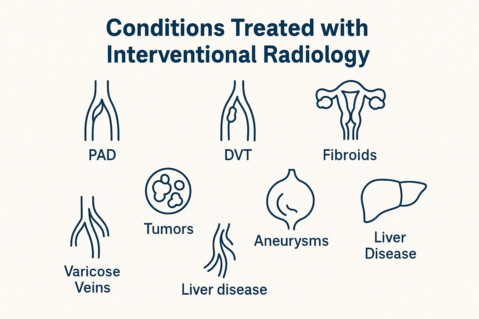 7 common conditions interventional radiologists treat, including PAD, DVT, fibroids, and aneurysms